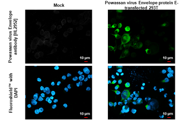 Anti-Powassan virus Envelope antibody [HL2952] used in Immunocytochemistry/ Immunofluorescence (ICC/IF). GTX640337